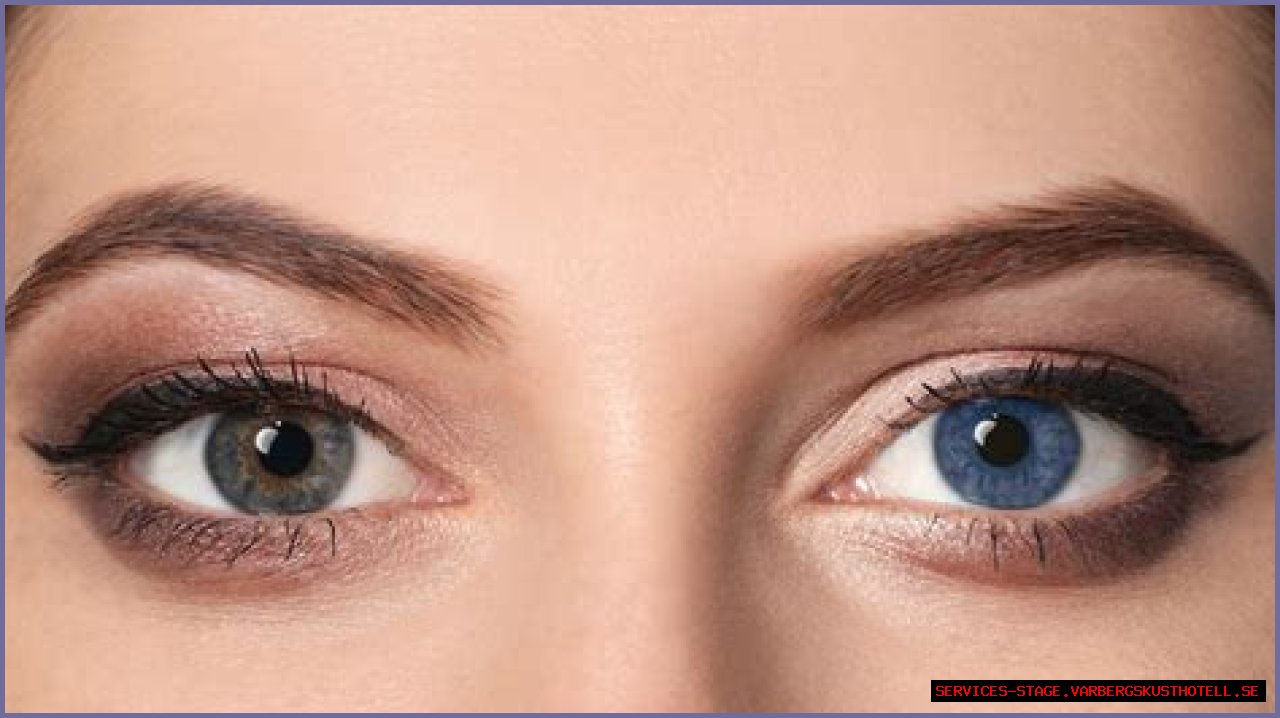 Discover The Allure Of Two Different Coloured Eyes