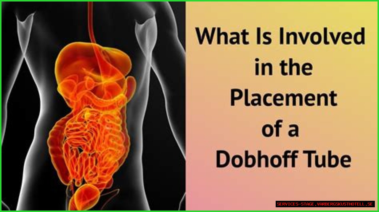 The Ultimate Guide To Dobhoff Tube Placement: Benefits, Procedure, And Aftercare