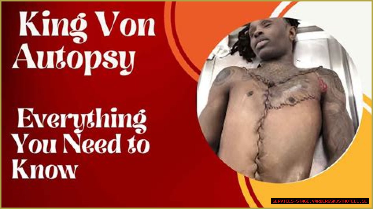 Unraveling The Mystery: King Von Body Autopsy